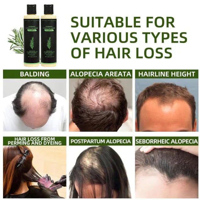(🔥LAST 3 HOURS SALE - 70% OFF)🌱 TRoot Revival Hair Growth Serum
