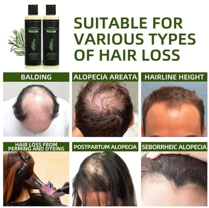(🔥LAST 3 HOURS SALE - 70% OFF)🌱 TRoot Revival Hair Growth Serum